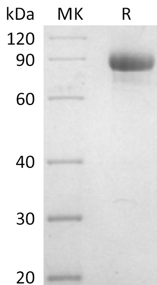 Cynomolgus CD93 +SDS-PAGE.jpg